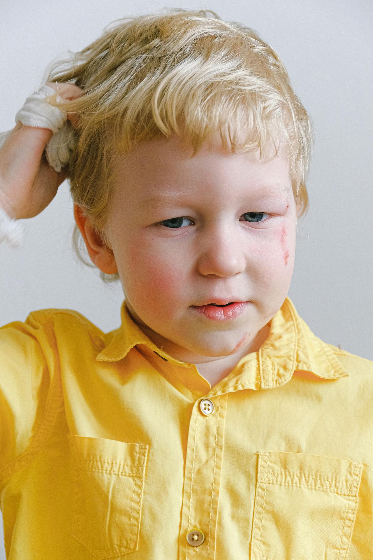 Brain Injury (Concussion / Stroke) 