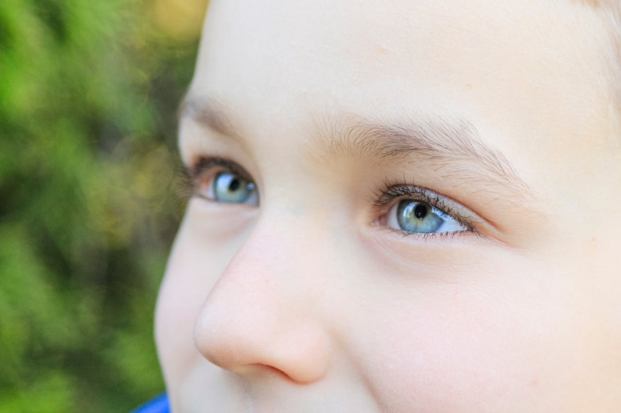 Strabismus (Eye Turn inward/outward) 